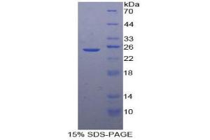 SDS-PAGE analysis of Human SDF2 Protein. (SDF2 蛋白)