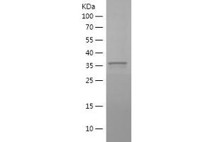 Western Blotting (WB) image for Polyhomeotic Homolog 2 (Drosophila) (PhC2) (AA 701-810) protein (His-IF2DI Tag) (ABIN7124511)