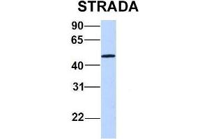 Host:  Rabbit  Target Name:  STRADA  Sample Type:  721_B  Antibody Dilution:  1. (STRADA 抗体  (C-Term))