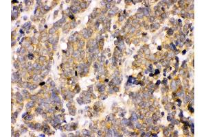 Immunohistochemistry (IHC) image for anti-3-phosphoinositide Dependent Protein Kinase-1 (PDPK1) (AA 524-556), (C-Term) antibody (ABIN3043600)