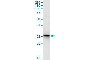 Western Blotting (WB) image for anti-Glutathione S-Transferase alpha 4 (GSTA4) (AA 1-222) antibody (ABIN516229)