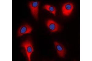 Immunofluorescent analysis of p39 staining in HeLa cells. (p39 (Center) 抗体)