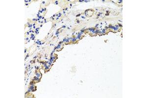 Immunohistochemistry of paraffin-embedded rat lung using TUBB8 antibody. (Tubulin, beta 8 抗体)