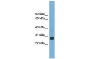 Image no. 1 for anti-MAX Dimerization Protein 1 (MXD1) (AA 681-730) antibody (ABIN6746140) (MXD1 抗体  (AA 681-730))