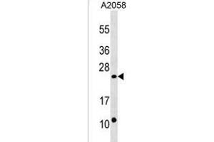DUSP13 Antibody (C-term) (ABIN1536729 and ABIN2850516) western blot analysis in  cell line lysates (35 μg/lane). (DUSP13 抗体  (C-Term))