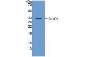 Detection of Recombinant PLCe1, Mouse using Polyclonal Antibody to Phospholipase C Epsilon 1 (PLCe1) (PLCE1 抗体  (AA 1-250))