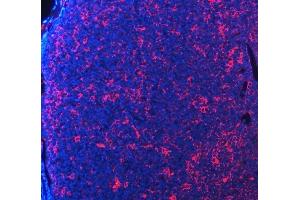 IF analysis of PDCD1 using anti-PDCD1 antibody (ABIN5518784). (PD-1 抗体  (N-Term))
