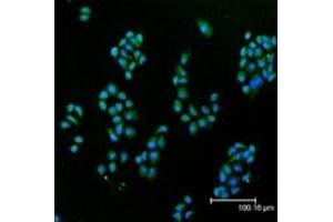 Immunofluorescent analysis (confocal) staining of HeLa cells using Cu/Zn SOD pAb (green), nuclei are stained in blue pseudocolor using DRAQ5. (SOD1 抗体)