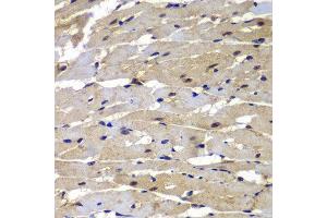 Immunohistochemistry (Paraffin-embedded Sections) (IHC (p)) image for anti-Proteasome (Prosome, Macropain) Subunit, beta Type, 8 (Large Multifunctional Peptidase 7) (PSMB8) (AA 163-272) antibody (ABIN6146321)
