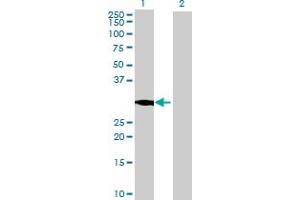 Western Blot analysis of CYB5D1 expression in transfected 293T cell line by CYB5D1 MaxPab polyclonal antibody. (CYB5D1 抗体  (AA 1-228))