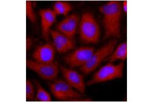 Immunofluorescence (IF) image for anti-Ornithine Aminotransferase (OAT) (AA 33-439) antibody (ABIN487353) (OAT 抗体  (AA 33-439))