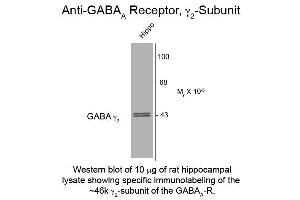 Western Blot of Anti-GABA(A) Receptor gamma 2 (Rabbit) Antibody - 112-401-C81 Western Blot of Rabbit Anti-GABA(A) Receptor gamma 2 Antibody. (GABRG2 抗体)