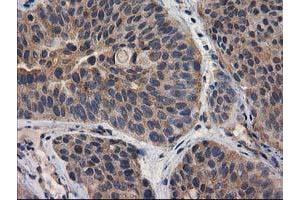 Image no. 17 for anti-Destrin (Actin Depolymerizing Factor) (DSTN) antibody (ABIN1497910) (Destrin 抗体)