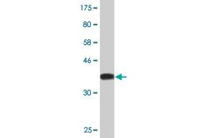 Western Blot detection against Immunogen (35. (Homeobox C6 抗体  (AA 53-142))