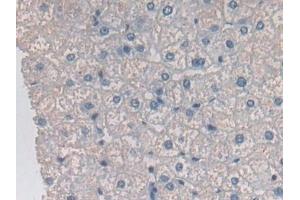 Immunohistochemistry (IHC) image for anti-Ornithine Aminotransferase (OAT) (AA 1-301) antibody (ABIN7441106)