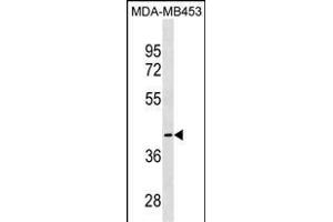 CCBL1 Antibody (C-term) (ABIN1537137 and ABIN2849997) western blot analysis in MDA-M cell line lysates (35 μg/lane). (CCBL1 抗体  (C-Term))