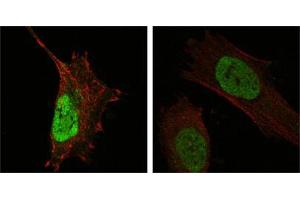 Confocal immunofluorescence analysis of Hela (left) and L-02 (right) cells using MDM4 mouse mAb (green). (MDM4-binding Protein 抗体)