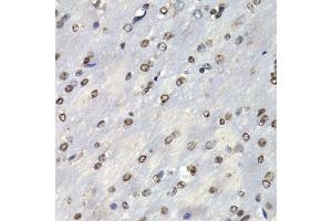 Immunohistochemistry (IHC) image for anti-Proteasome (Prosome, Macropain) Subunit, beta Type 10 (PSMB10) (AA 1-273) antibody (ABIN6146311)