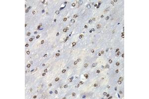 Immunohistochemistry of paraffin-embedded mouse brain using PSMB10 antibody (ABIN6132527, ABIN6146311, ABIN6146312 and ABIN6221107) at dilution of 1:200 (40x lens). (PSMB10 抗体  (AA 1-273))