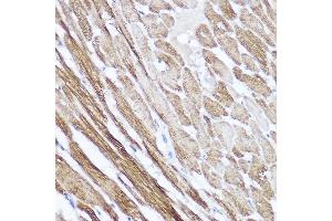 Immunohistochemistry of paraffin-embedded rat heart using NPPA Rabbit pAb (ABIN7268829) at dilution of 1:100 (40x lens). (NPPA 抗体  (AA 26-151))
