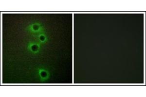 Immunofluorescence analysis of A549 cells, using MARK4 Antibody. (MARK4 抗体  (Internal Region))