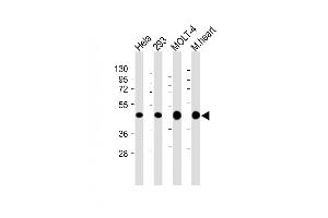All lanes : Anti-MTHFD2 Antibody (C-term) at 1:4000 dilution Lane 1: Hela whole cell lysate Lane 2: 293 whole cell lysate Lane 3: MOLT-4 whole cell lysate Lane 4: Mouse heart lysate Lysates/proteins at 20 μg per lane. (MTHFD2 抗体  (C-Term))