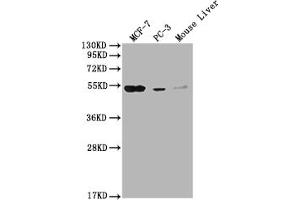 Western Blot Positive WB detected in: MCF-7 whole cell lysate, PC-3 whole cell lysate, Mouse Liver tissue All lanes: MOCS3 antibody at 1:2000 Secondary Goat polyclonal to rabbit IgG at 1/50000 dilution Predicted band size: 50 kDa Observed band size: 50 kDa (MOCS3 抗体  (AA 279-404))