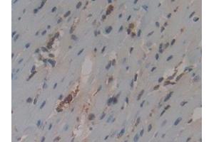 Detection of CYCS in Mouse Heart Tissue using Polyclonal Antibody to Cytochrome C (CYCS) (Cytochrome C 抗体  (AA 13-99))