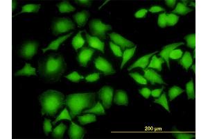 Immunofluorescence (IF) image for anti-Non-Metastatic Cells 1, Protein (NM23A) Expressed in (NME1) (AA 43-152) antibody (ABIN562004)