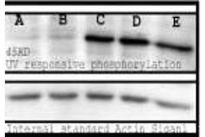 Phosphoserine, mouse spleen lysate, UV response. (Phosphoserine 抗体)