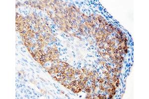 anti-hCG Receptor (N-Term) antibody