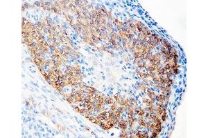 IHC-P: hCG receptor antibody testing of rat ovary tissue (hCG Receptor (N-Term) 抗体)