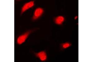 Immunofluorescent analysis of PTTG1/2/3 staining in Jurkat cells. (PTTG1/2/3 抗体  (Center))
