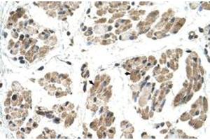 Immunohistochemical staining (Formalin-fixed paraffin-embedded sections) of human muscle with FKTN polyclonal antibody  at 4-8 ug/mL working concentration. (Fukutin 抗体  (N-Term))