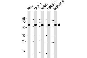 All lanes : Anti-Hsp60 Antibody at 1:2000 dilution Lane 1: Hela whole cell lysate Lane 2: MCF-7 whole cell lysate Lane 3: Jurkat whole cell lysate Lane 4: NIH/3T3 whole cell lysate Lane 5: mouse thymus lysate Lysates/proteins at 20 μg per lane. (HSPD1 抗体  (AA 340-374))