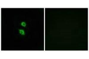 Immunofluorescence analysis of MCF-7 cells, using ARSD antibody. (Arylsulfatase D 抗体)