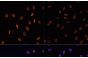 Immunofluorescence analysis of NIH/3T3 cells using Acetyl-Histone H2B-K12 Polyclonal Antibody at dilution of 1:100. (Histone H2B 抗体  (acLys12))
