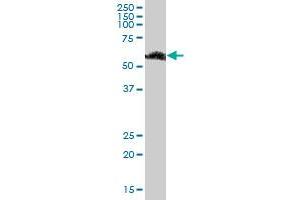 Western Blotting (WB) image for anti-RNA Binding Motif Protein, Y-Linked, Family 1, Member F (RBMY1F) (AA 1-496) antibody (ABIN949881)