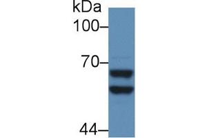 Detection of a2PI in Mouse Liver lysate using Polyclonal Antibody to Alpha 2-Antiplasmin (a2PI) (alpha 2 Antiplasmin 抗体  (AA 348-491))
