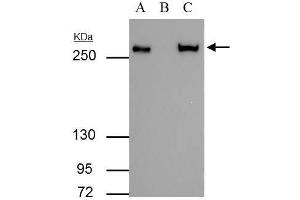 IP Image FASN antibody immunoprecipitates FASN protein in IP experiments. (Fatty Acid Synthase 抗体  (N-Term))