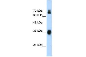 WB Suggested Anti-KEAP1 Antibody Titration:  1. (KEAP1 抗体  (C-Term))