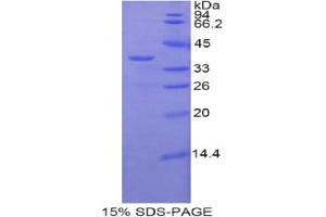 SDS-PAGE analysis of Mouse zAP70 Protein. (ZAP70 蛋白)