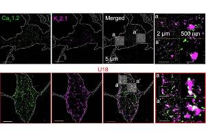 Representative super-resolution TIRF images of CTL (black) and U18-treated (red) neurons co-immunolabeled for CaV1.
