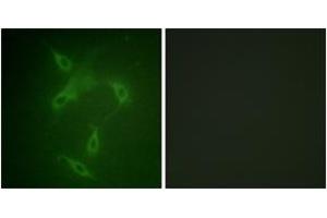 Immunofluorescence analysis of NIH-3T3 cells, using JAK2 (Ab-570) Antibody. (JAK2 抗体  (AA 541-590))