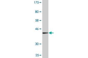 Western Blot detection against Immunogen (41. (TSC22D1 抗体  (AA 1-144))