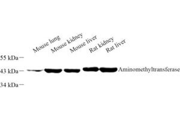 Aminomethyltransferase 抗体