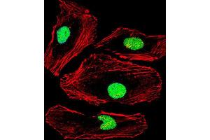 Immunofluorescence (IF) image for anti-Methyl-CpG Binding Domain Protein 2 (MBD2) antibody (ABIN3001197) (MBD2 抗体)