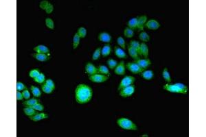 Immunofluorescent analysis of HepG2 cells using ABIN7148059 at dilution of 1:100 and Alexa Fluor 488-congugated AffiniPure Goat Anti-Rabbit IgG(H+L) (CCHCR1 抗体  (AA 483-782))
