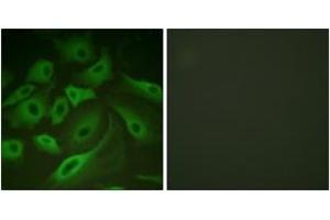 Immunofluorescence analysis of HeLa cells, using PLB (Ab-16/17) Antibody. (Phospholamban 抗体  (AA 1-50))
