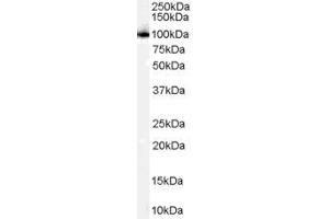 Western Blotting (WB) image for anti-Proteasome (Prosome, Macropain) 26S Subunit, Non-ATPase, 2 (PSMD2) (C-Term) antibody (ABIN185319)